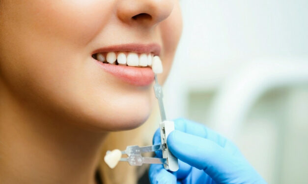 Którą metodę wybielania zębów wybrać?